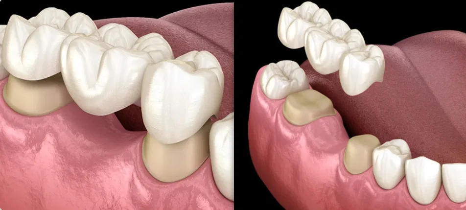 For Your Smile Dental clinic Calgary NW Crowfoot