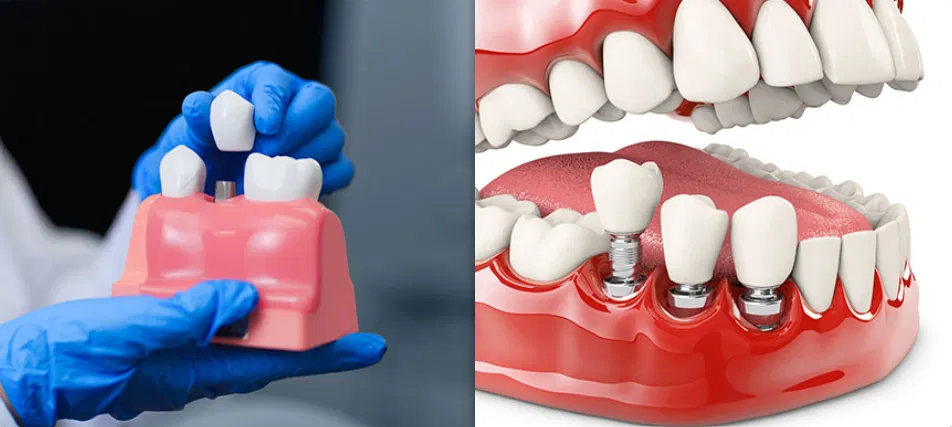 For Your Smile Dental clinic Calgary NW Crowfoot