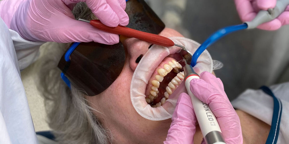 Guided Biofilm Therapy cleaning Calgary NW