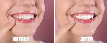 For Your Smile Dental clinic Calgary NW Crowfoot