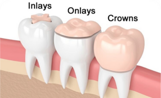 For Your Smile Dental clinic Calgary NW Crowfoot
