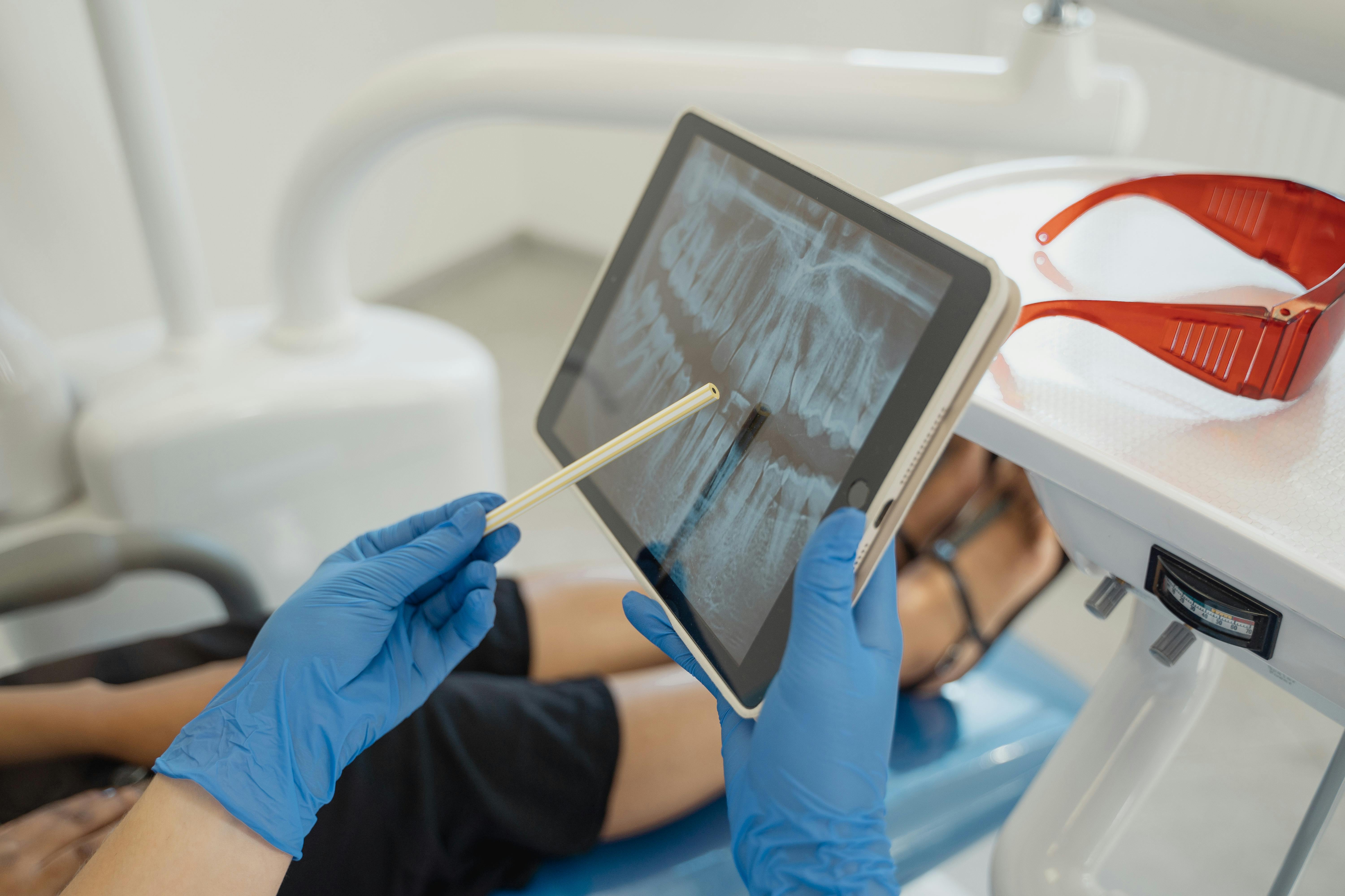 Root canal therapy Calgary NW dental clinic