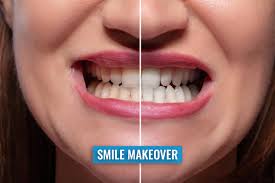 For Your Smile Dental clinic Calgary NW Crowfoot